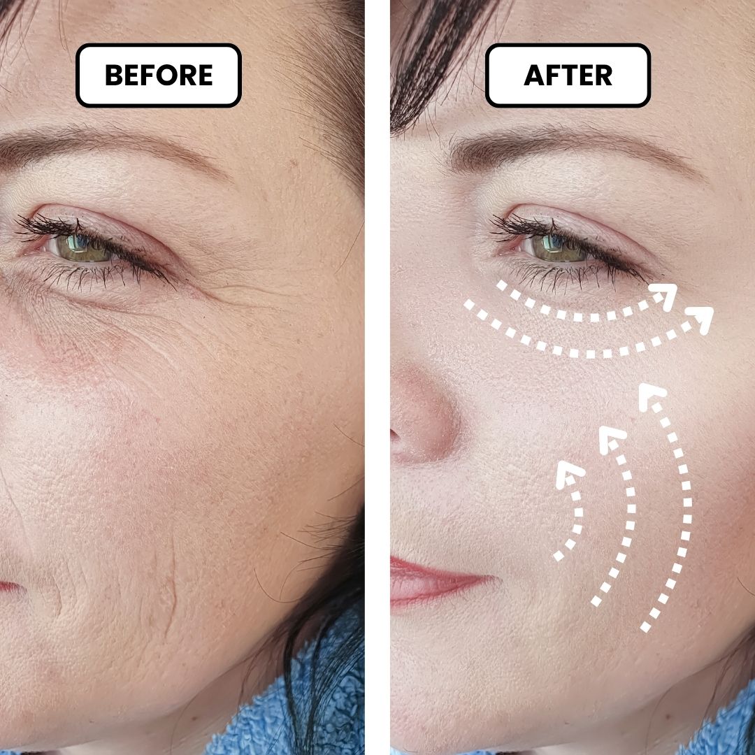 La Lune | 7-in-1 Anti-Aging Therapeutic Device