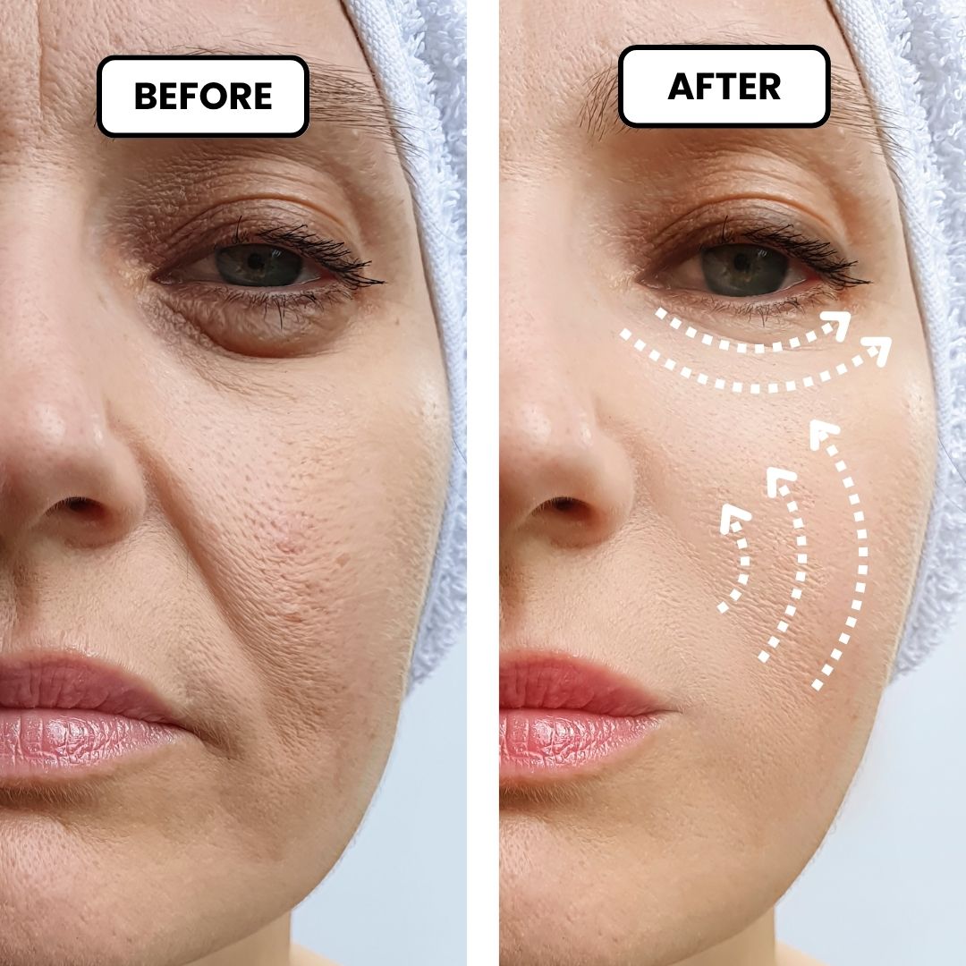 La Lune | 7-in-1 Anti-Aging Therapeutic Device
